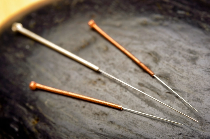 Does Acupuncture Hurt? Does Acupuncture Hurt?