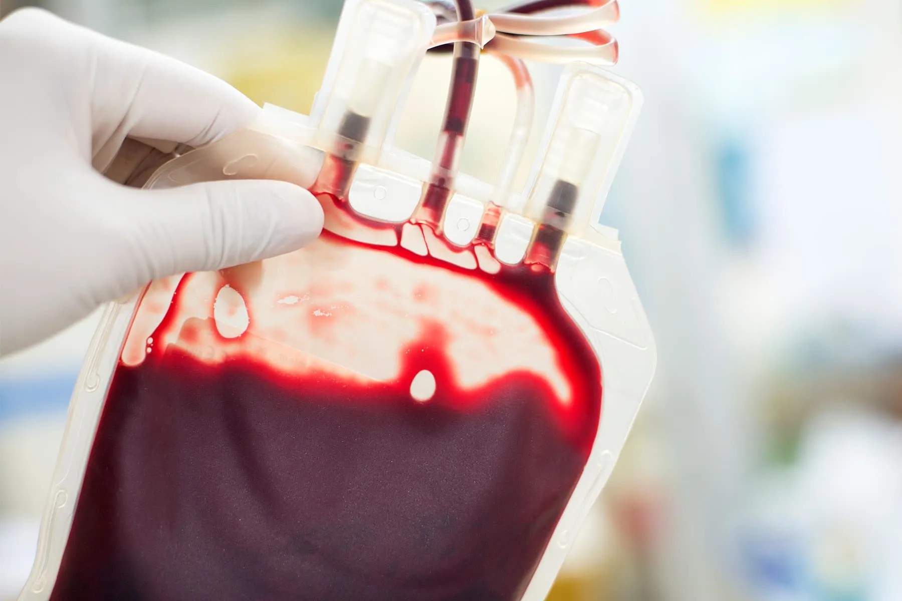 photo of blood bag close up