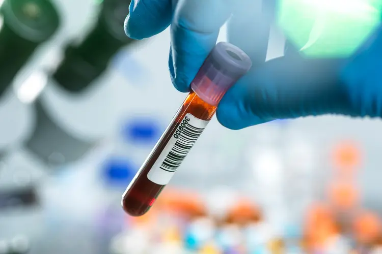 photo of blood vial