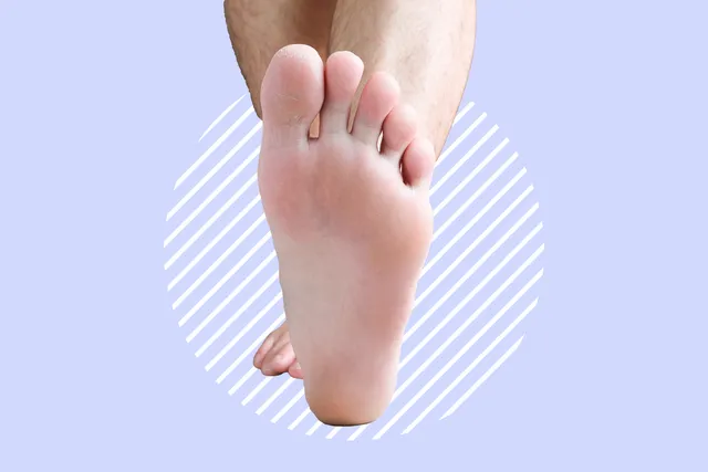 What to Know About High Arches