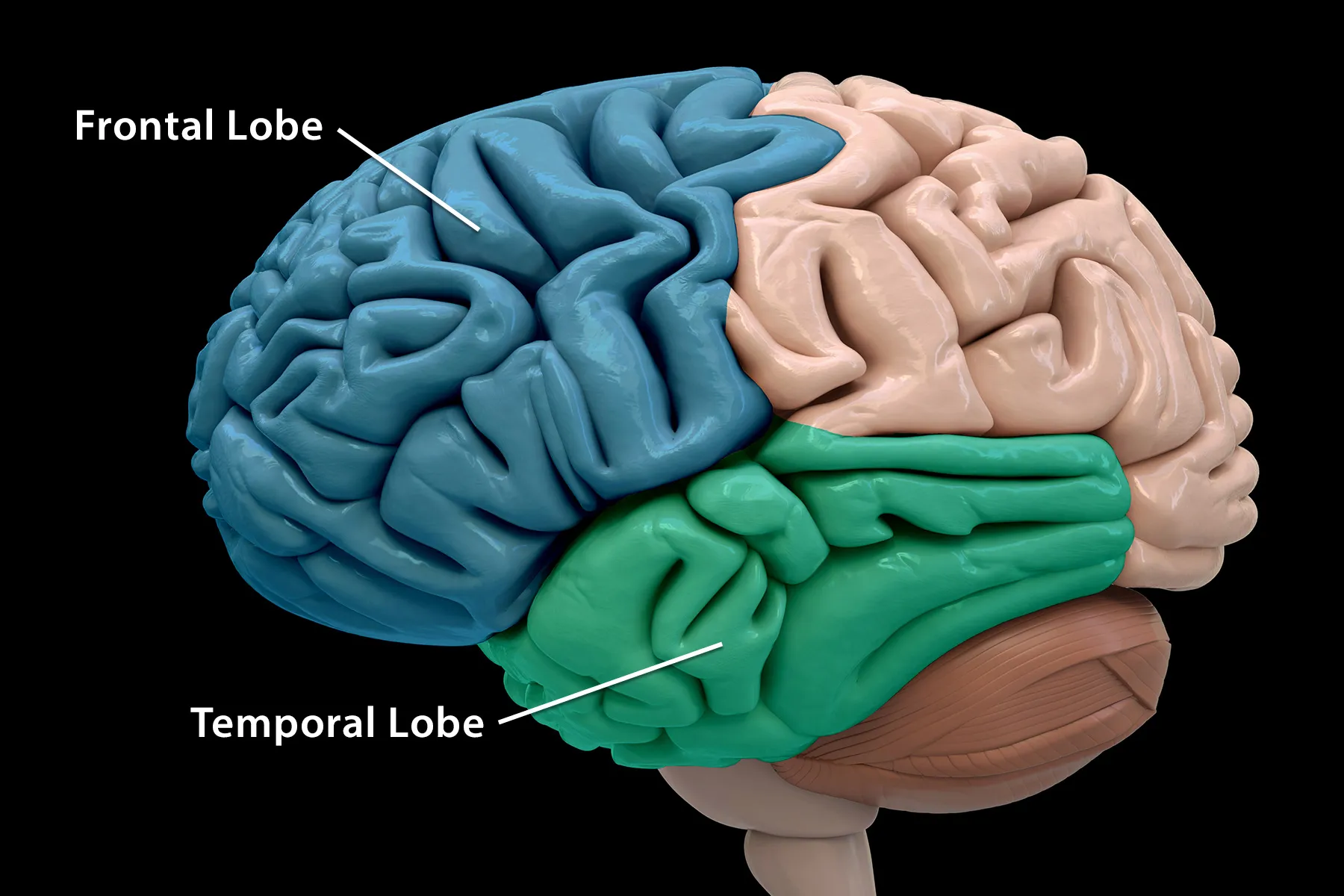 photo of brain anatomy highlighting frontal and temporal lobes