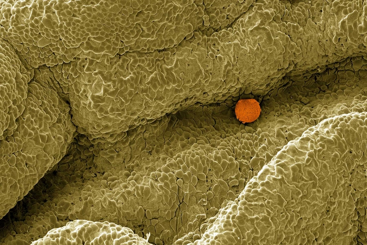 Moving Into the Fallopian Tube