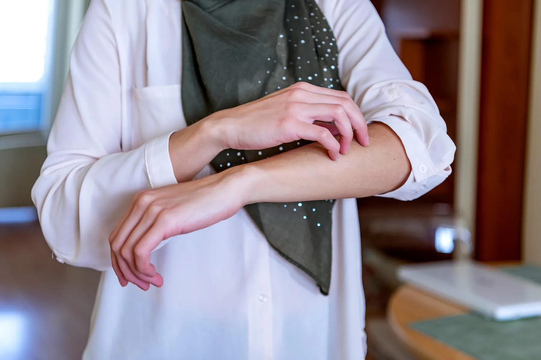 photo of woman scratching arm