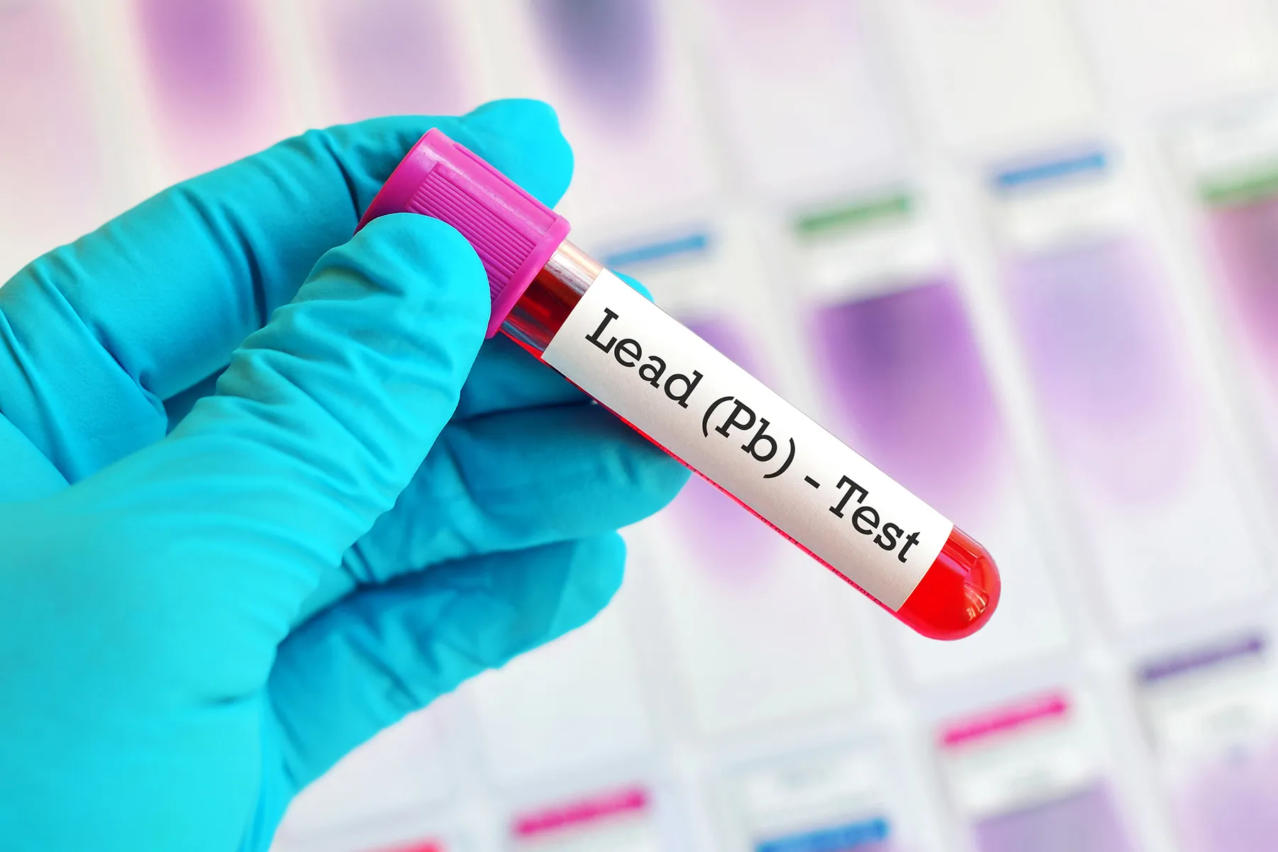 photo of lead blood test