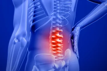 Ankylosing spondylitis usually starts in your lower back but can spread up to your neck or damage joints in other parts of your body. Photo Credit: Wavebreakmedia Ltd / Getty Images