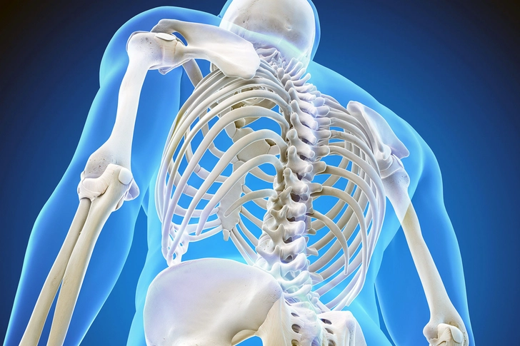 Bisphosphonate Therapy 