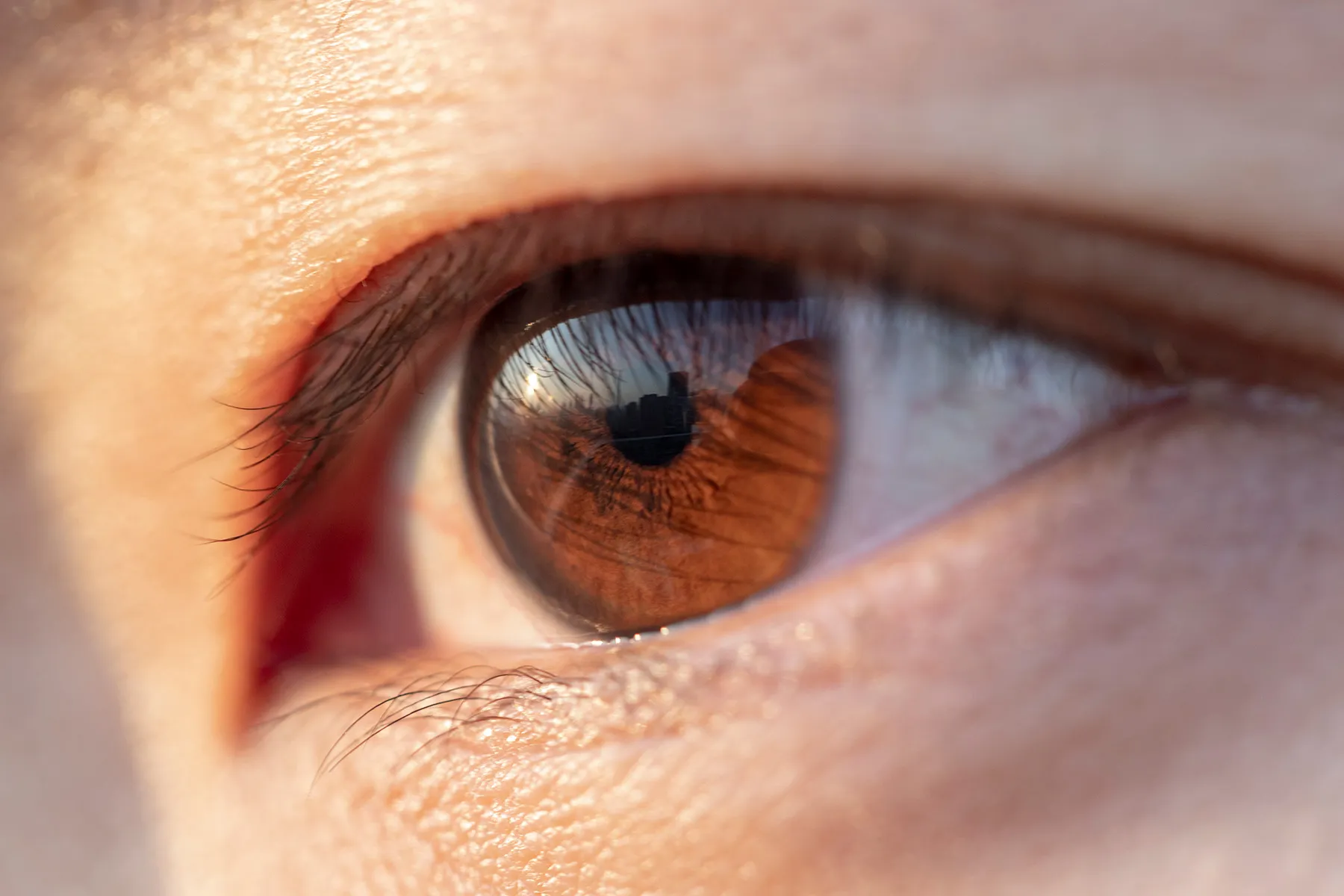 What Is Diabetic Macular Edema?