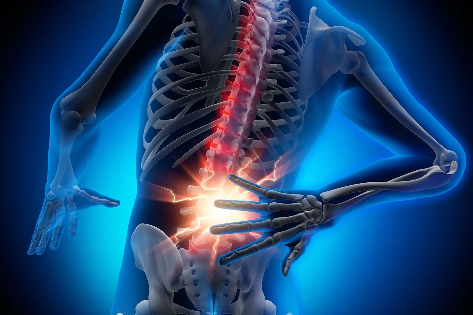 Spotlight on Non-Radiographic Axial Spondyloarthritis
