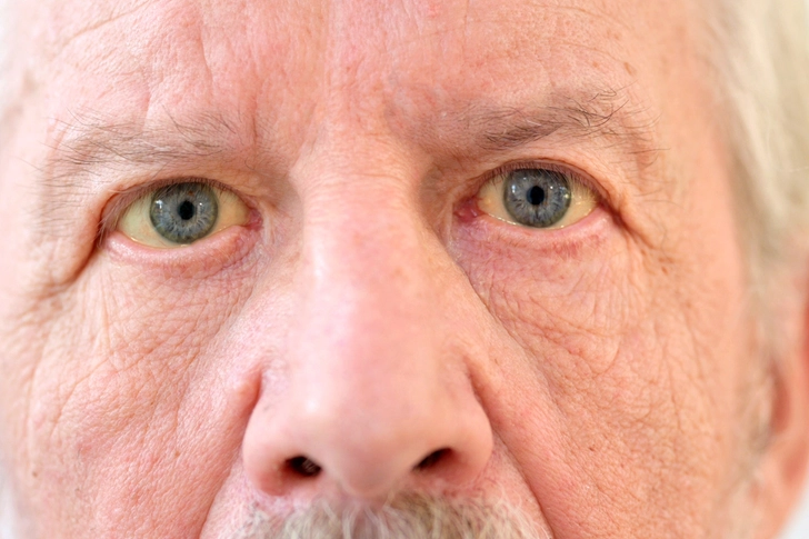 Rare, Serious Side Effects