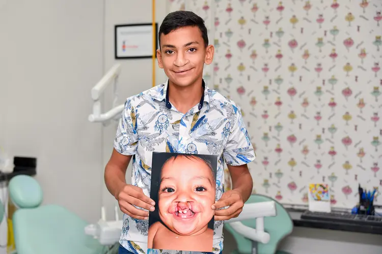 photo of before and after young man and photo