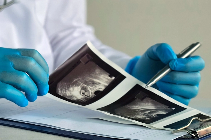 What Happens Before the Procedure? 