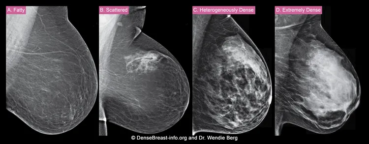 photo breast imaging categories