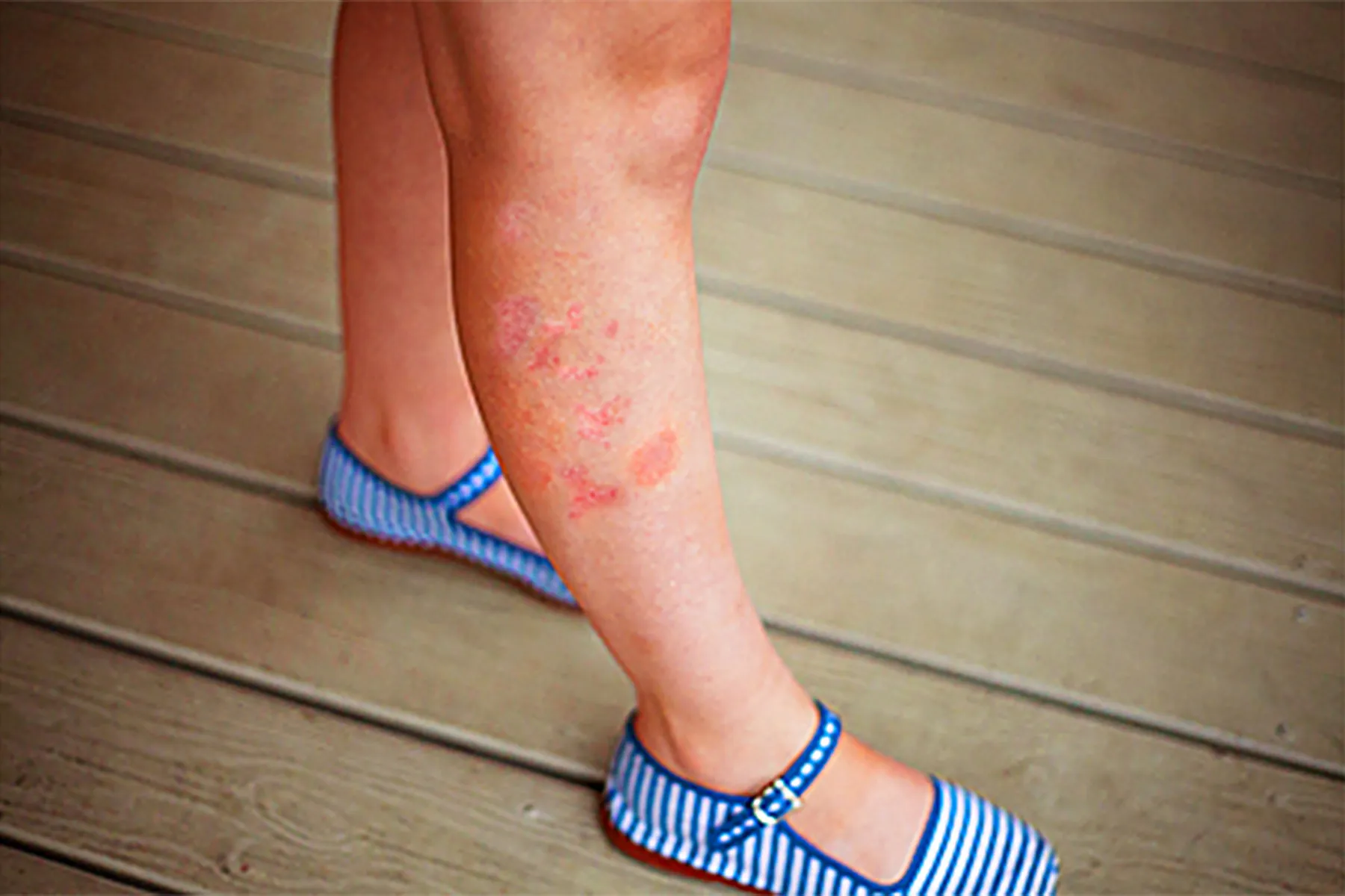 The Truth About Triggers and Treatments