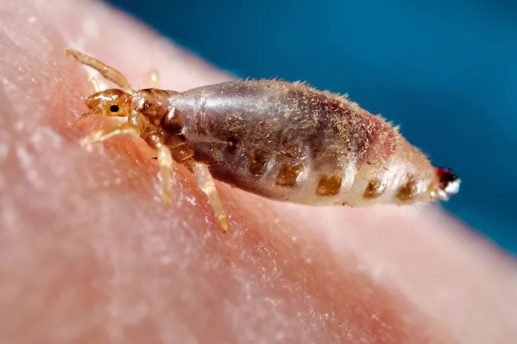 photo of body lice