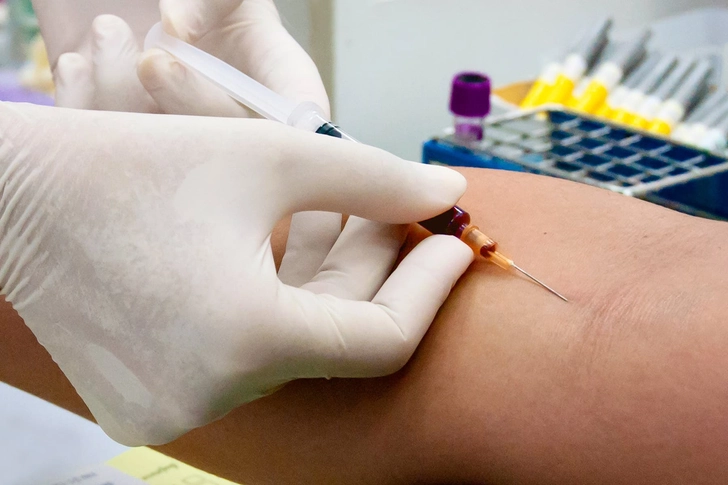 What Can Iron Studies Tell You?