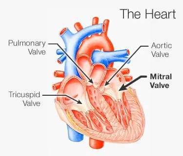 Picture of mitral valve in heart