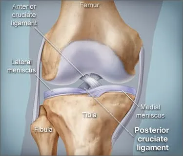 Picture of posterior cruciate ligament