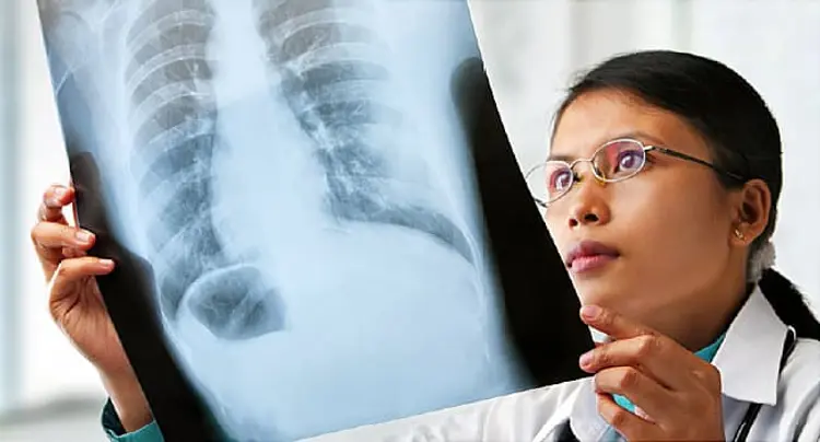 650x350_renal_cell_spread_bones_ref_guide