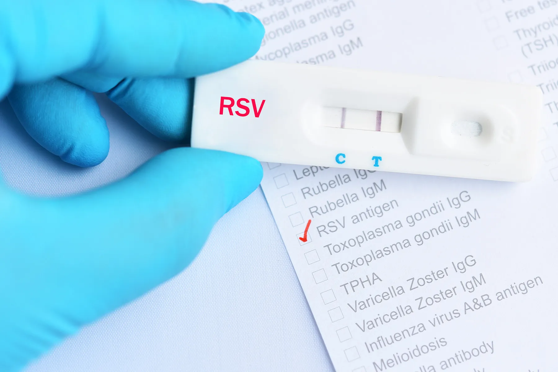 photo of rsv antigen test