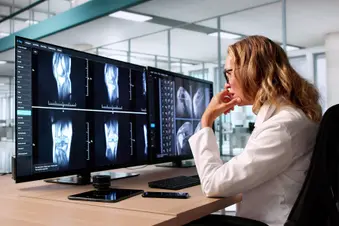 photo of doctor examining knee mri scan