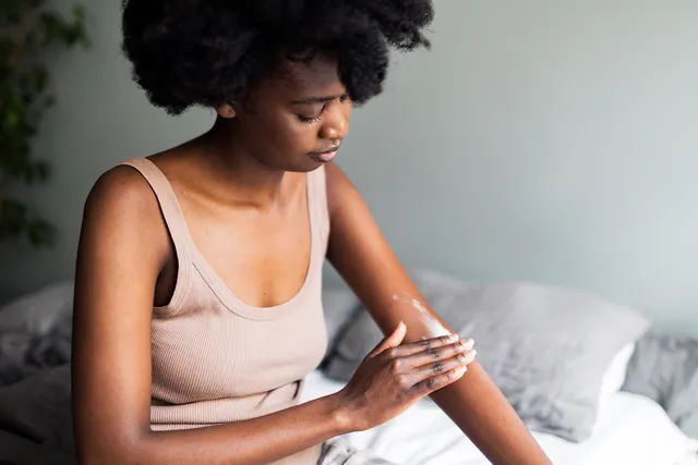 Treating Atopic Dermatitis