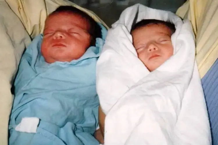 photo of Twin-to-twin “transfusion”
