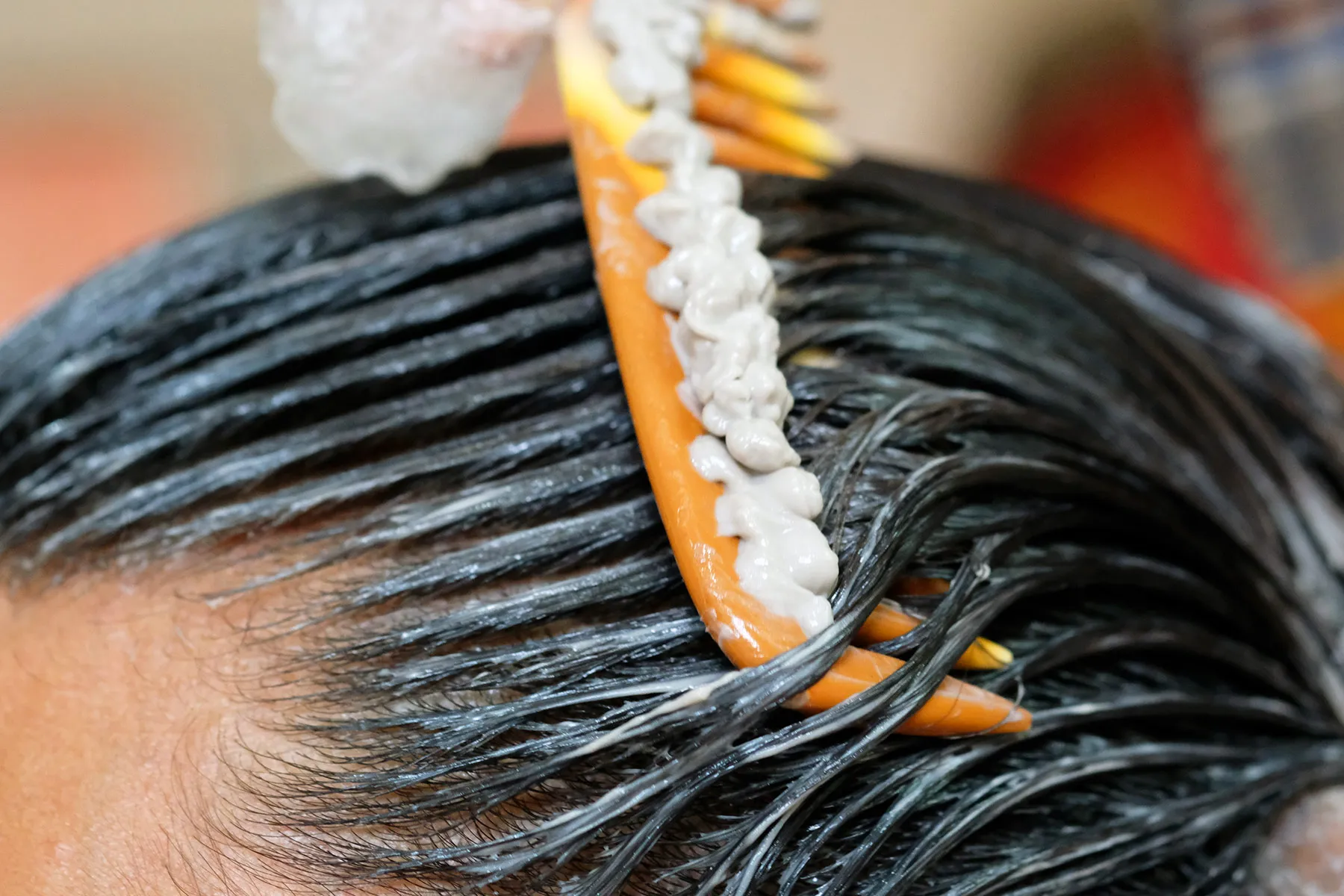 Watch for Hair Restoration Scams