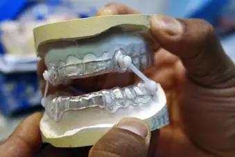 photo of dentist fitting oral appliance