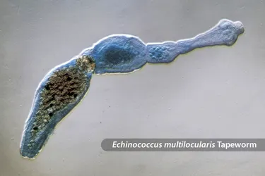 Tiny tapeworms cause alveolar echinococcosis.