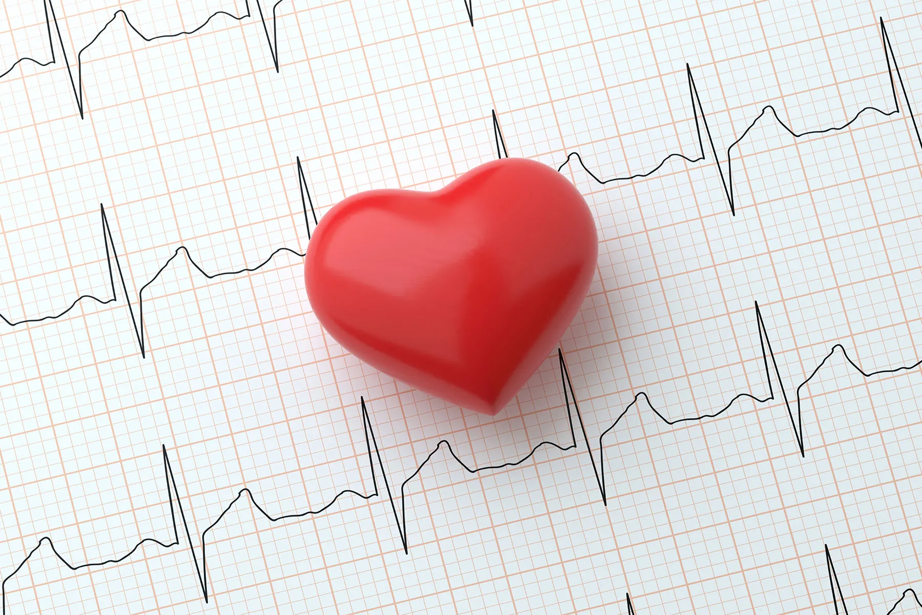 3 New Findings on AFib and What They Mean