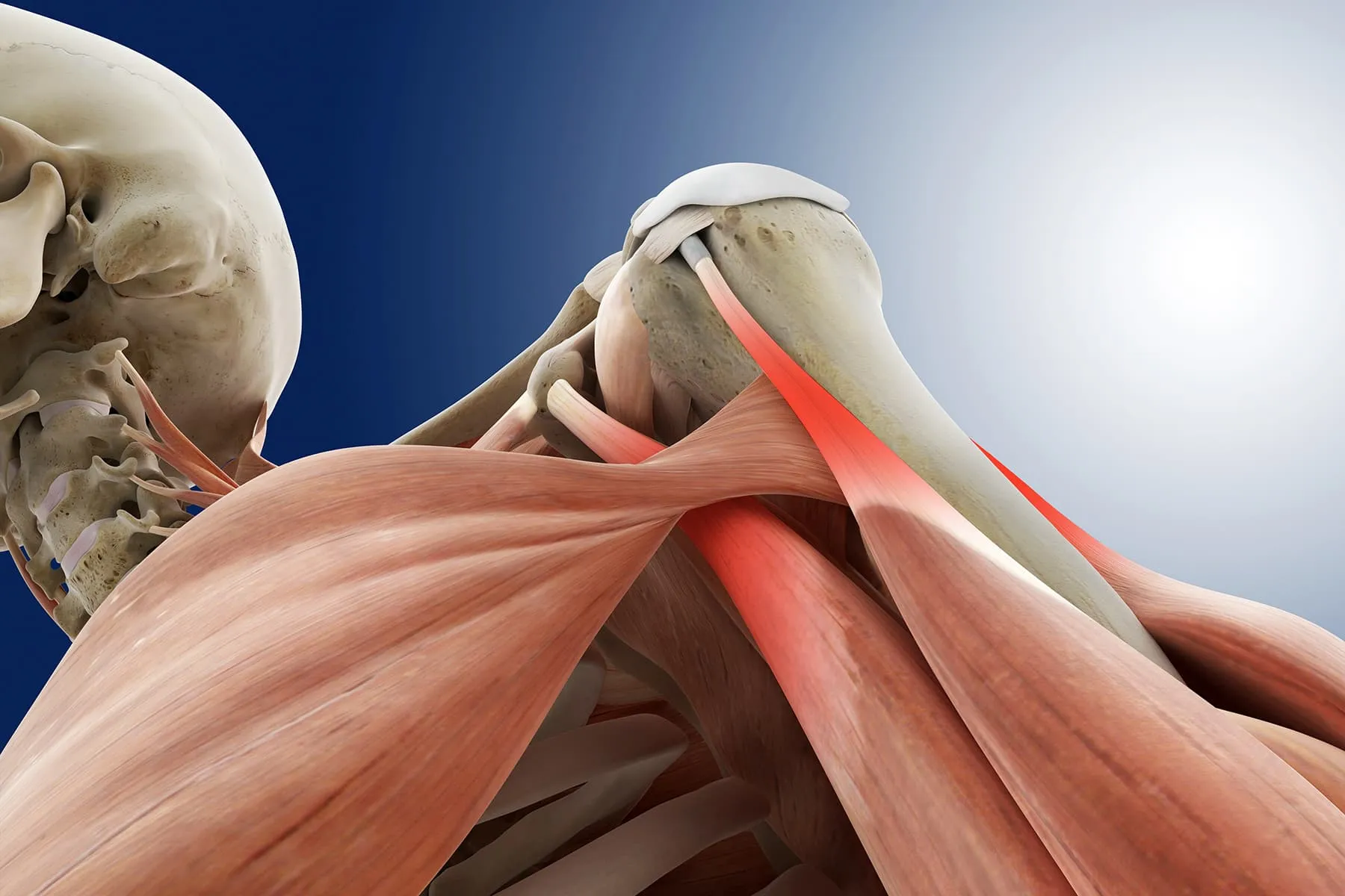 Visual Guide to Tendinitis Biology Diagrams