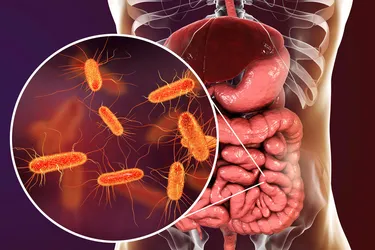Most cases of food poisoning and traveler's diarrhea are caused by E. coli bacteria. (Photo credit: iStock/Getty Images)