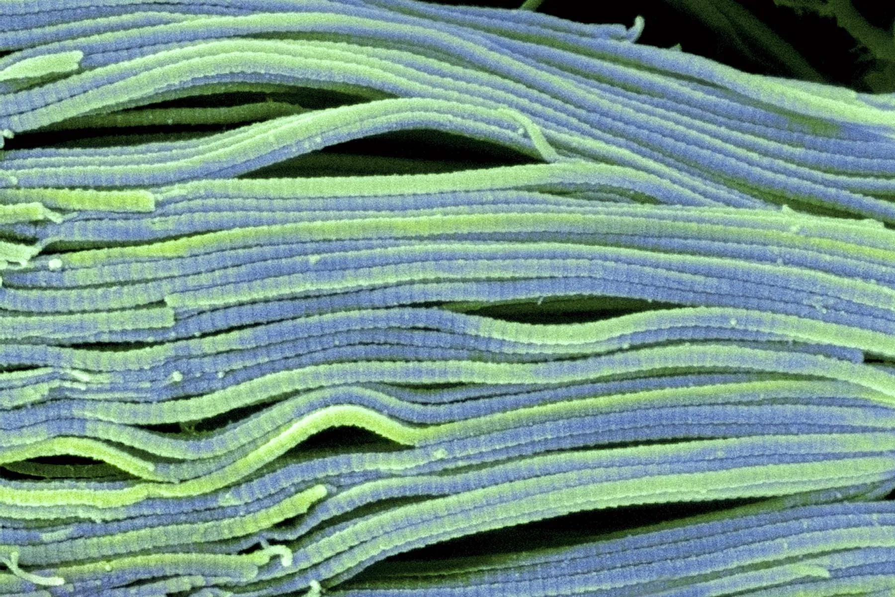 Collagen and Your Body
