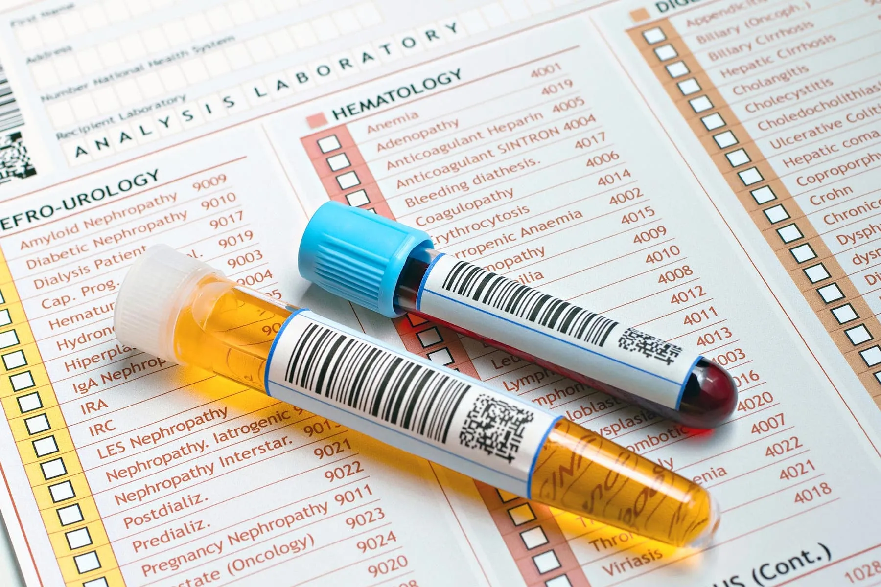 Ursachen für Blut im Urin