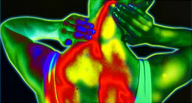 a Visual Guide to Understanding Fibromyalgia