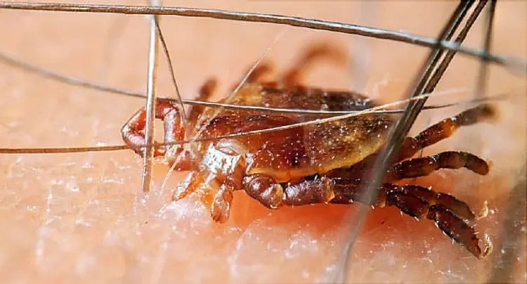tick biting human skin close up