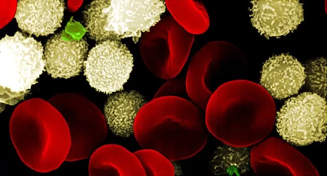 Sepsis 101: Symptome, Behandlung und mehr