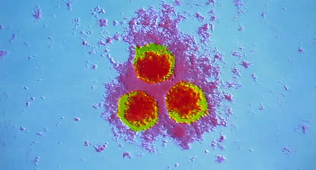 Shingles Pictures: What the Shingles Rash Looks Like