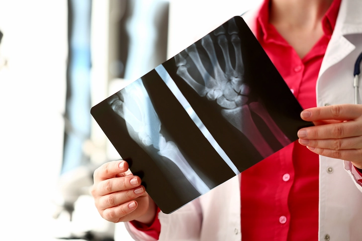 Keep an Eye On Your Bone Health Keep an Eye On Your Bone Health