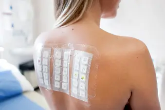 photo of allergy test