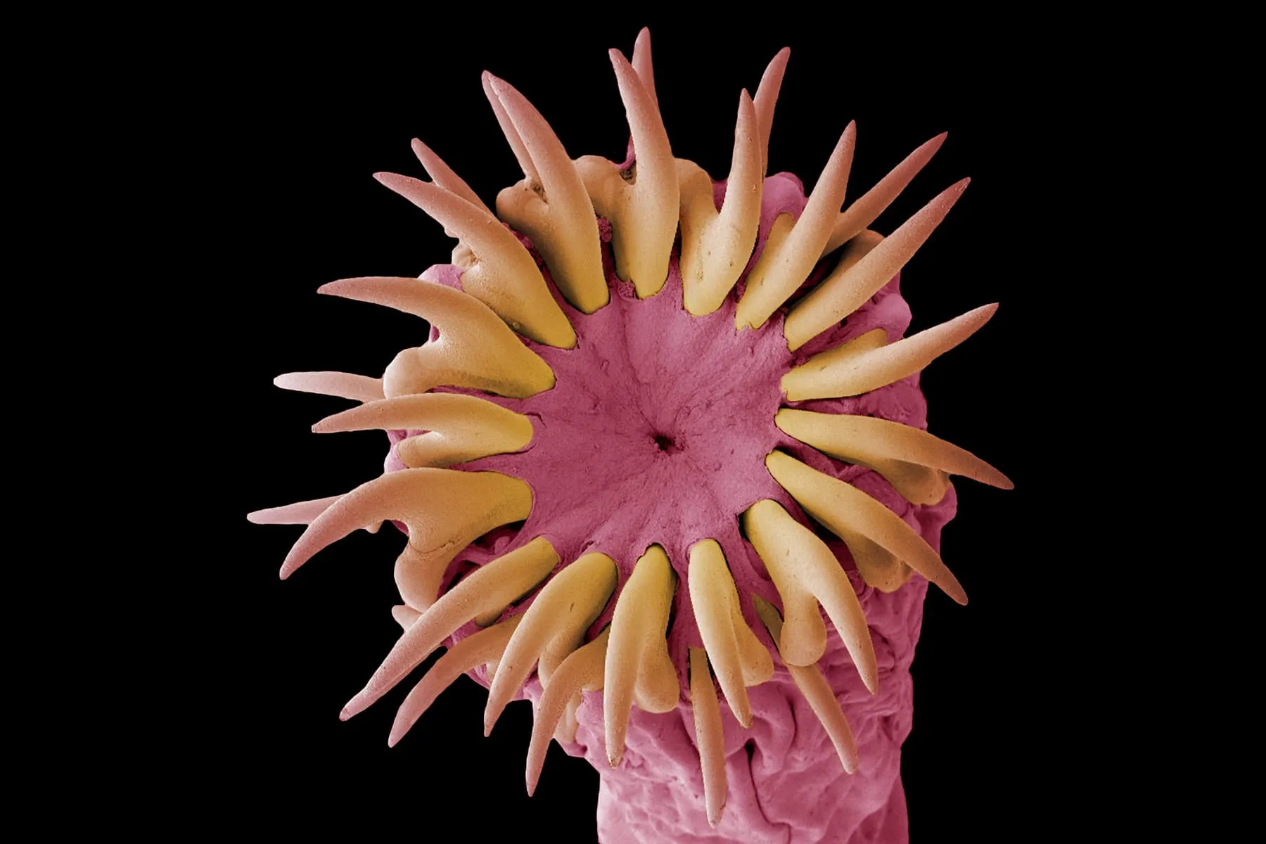 What You Should Know About Tapeworms