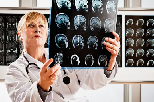photo of neurologist examining mri scans of brain