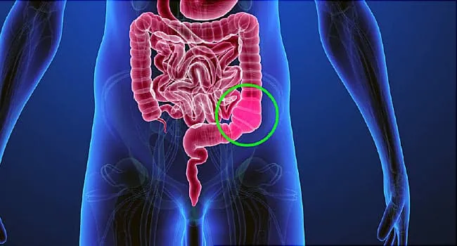 Reasons You May Be Constipated reasons-you-may-be-constipated