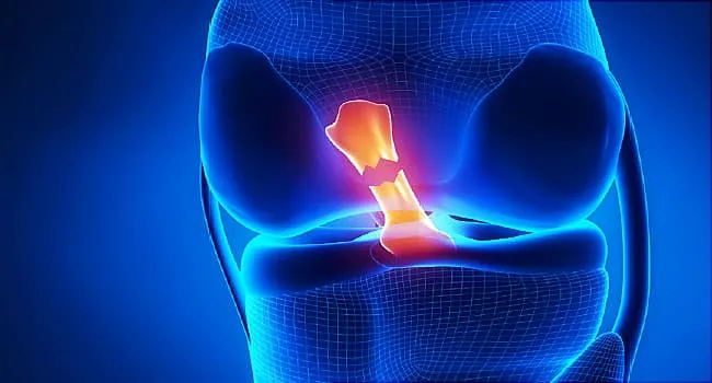 Why Knees Hurt