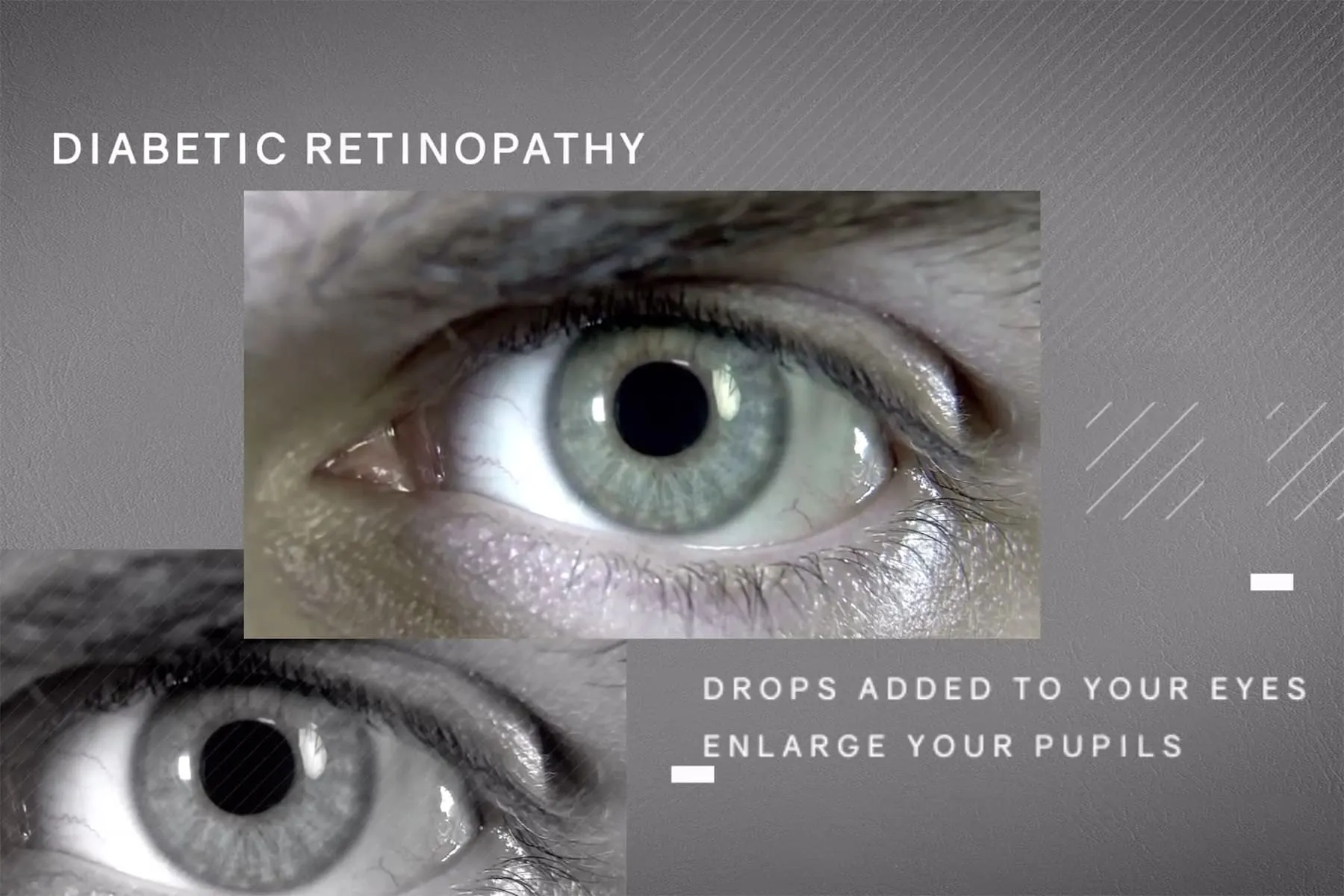 How Your Eye Doctor Finds Diabetic Retinopathy