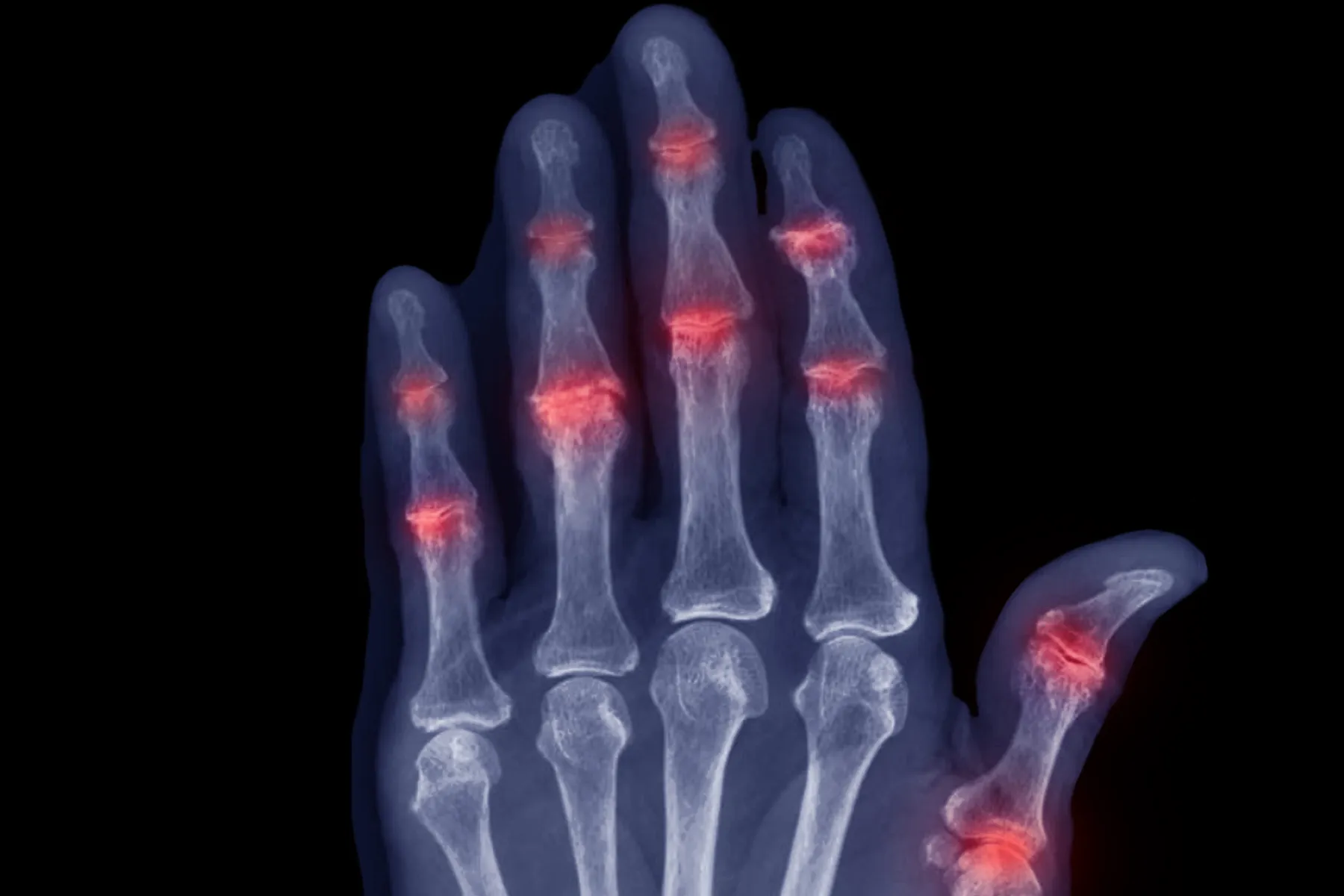 Telltale Markers for Diagnosis