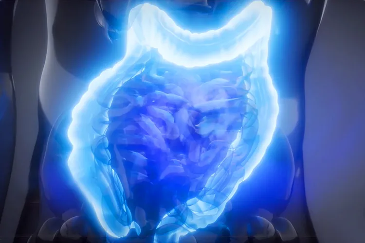 The Truth About Ulcerative Colitis