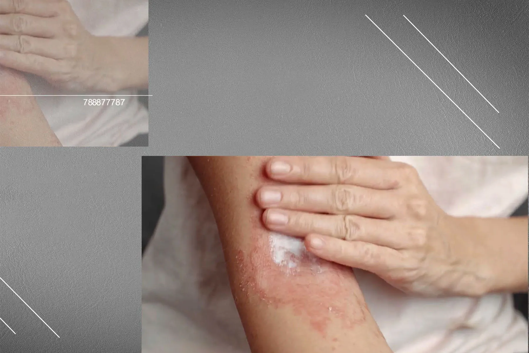 Stress Relief Can Also Calm Your Skin
