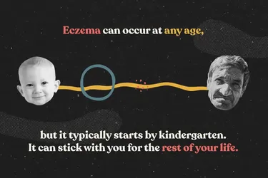 How Does AD Affect Your Body?