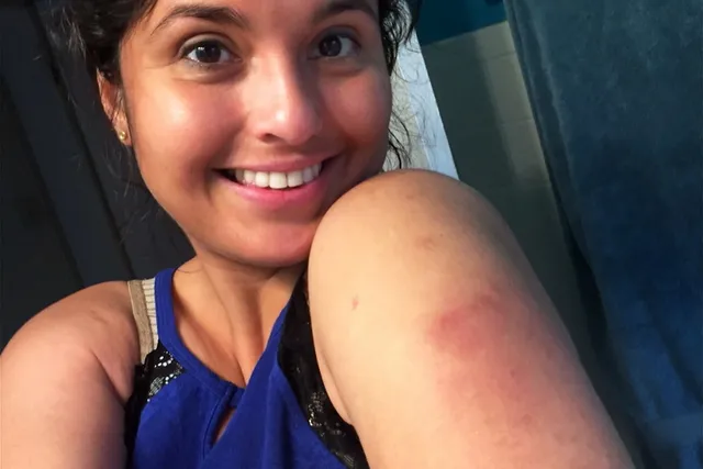 More Than Just Dry Skin